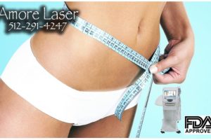Laser Lipo Treatments