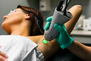 Does laser hair removal hurt?