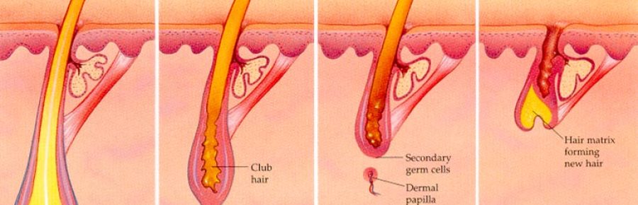 Laser Hair Removal After-Care, what you need to know.